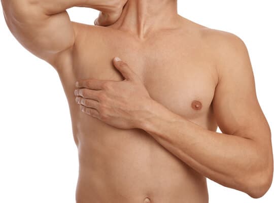 Gynecomastia