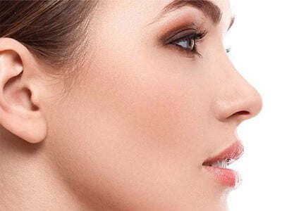 Rhinoplasty