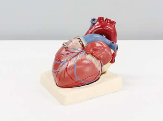 project-healthcare-risk-factors-for-heart-diseases-3