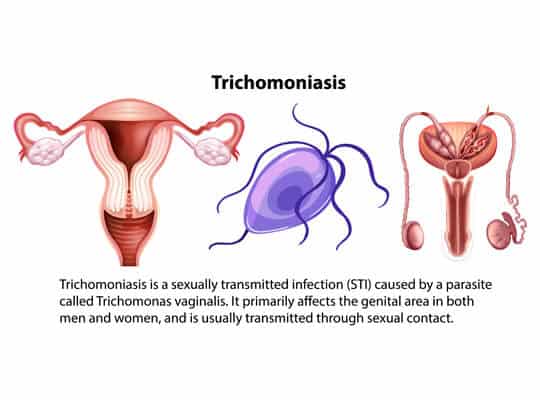 project-healthcare-trichhomonas-vaginalis-2